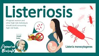 Listeriosis (Listeria Monocytogenes) | Sources, Pathophysiology, Symptoms, Diagnosis, Treatment