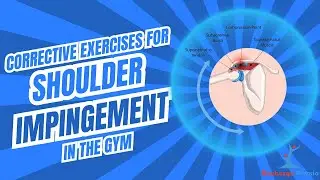 Corrective exercises for Shoulder Impingement in the gym