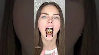 Life Doodles | Nut in the mouth 😂 