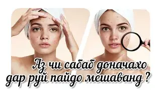 ЯК ХОҲИШ😔 Доначахо дар руй.  Сабаби пайдоиш 