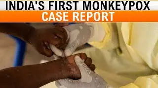 Monkeypox Case in India : India Reports First Suspected Case | What You Need to Know | News9