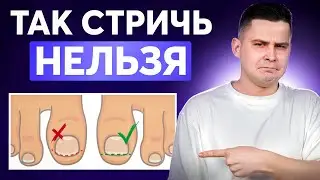 ВОСПАЛЯТСЯ ПАЛЬЦЫ! Как правильно стричь ногти младенцу?