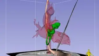 Transgastric Mid-Papillary Short-Axis Imaging Plane in TEE - Standard View