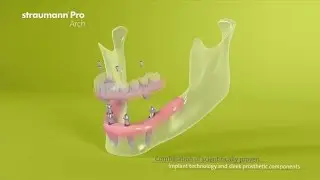 Straumann® Pro Arch (US Version)