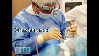 Септопластика, гайморотомія, вазотомія / Септопластика, гайморотомия, вазотомия