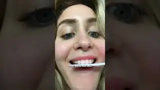 How to Survive the TikTok Veneer Trend 