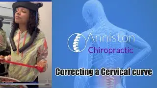 Correcting a reversed cervical curve