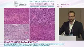 Перекрёстная иммуногистохимическая аберрантность недифференцированных круглоклеточных сарком