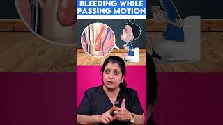 Bleeding while passing motion🚽🩸 