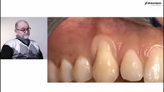 Prof. Giovanni Zucchelli:  Treatment of class I gingival recession