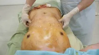 Plastic Surgery #21 What a body teenage girl, but she's want a perfection