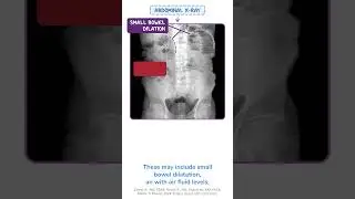 Diagnostics on Demand: Mechanical obstruction