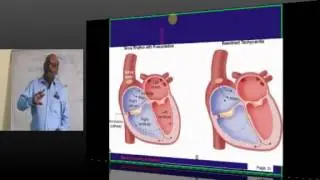 NEETPG Coaching Medicine Cardiology Topic 11 ECG Part 01 by Dr.Murali Bharadwaz