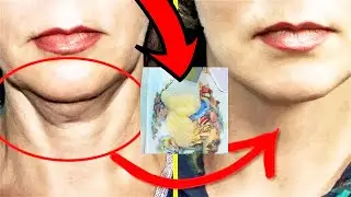 In 60 NECK AND FACE AS IN 30 years I show what I do from wrinkles and Flabbiness Face Mask