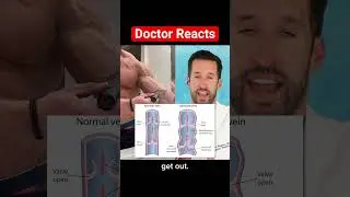 ER Doctor REACTS to World's Largest Veins
