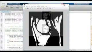 Digital image processing projects using matlab pdf