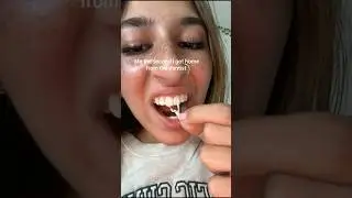 Why You SHOULD NOT Remove This After Going To The Dentist! 😳🦷 