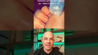 Derm reacts to failed splinter removal! 