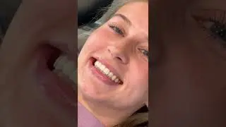 How Braces Are Removed 🦷 