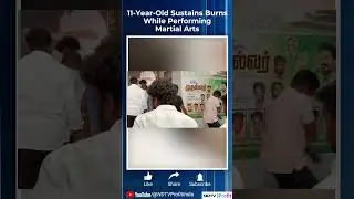 11-Year-Old Child Sustains Burns While Performing Martial Arts In Tamil Nadu #shorts