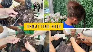 Dematting Little Boy's Matted Hair