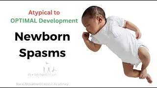 Atypical Development Baby and Newborn Spasms