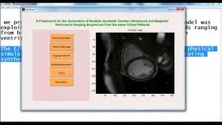 Projects Based on Image Processing Using Matlab | Thesis Based on Image Processing Using Matlab