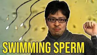 How do Sperm Swim?