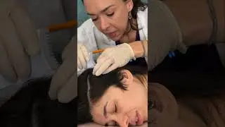 Asmr scalp tingles #asmr #asmrsounds #asmrvideo #relax #relaxing #satisfying #hair #sleep #tingles