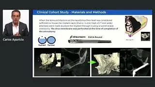 The Straumann® Zygomatic implant: 2-year clinical results, Dr Carlos Aparicio