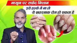 नाखून पर सफेद दाग! जानें कौन सी बीमारी के हैं संकेत | Nakhun Par Safed Nishan Ka Matlab