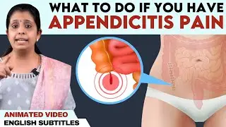 Appendicitis pain | Permanent relief | அப்பெண்டிசிடிஸ்-க்கு அறுவை சிகிச்சை தான் தீர்வா?