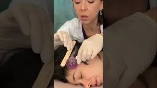 Asmr scalp tingles #asmr #asmrsounds #asmrvideo #relax #relaxing #satisfying #hair #sleep #tingles