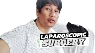 GALLBLADDER REMOVAL JOURNEY | LAPAROSCOPIC SURGEY | GALLSTONE
