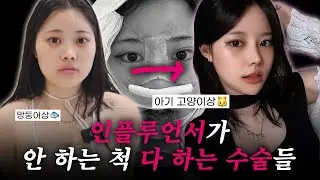 네모네모 sign 가득한 얼굴 → 고양이상 인플루언서가 되는 방법 | 윤곽2종 + 코 + 뒤밑트임 (후기O)