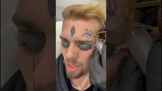 Удалили тату СПИД лазером за 1 сеанс в клинике Sokolov Laser 