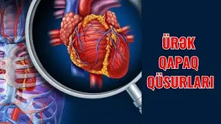 Ürək QAPAQ Çatışmazlığı - Anadangəlmə ÜRƏK QÜSURUDUR?