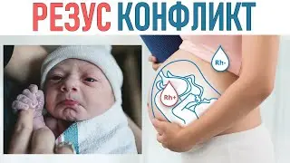 РЕЗУС КОНФЛИКТ ПРИ БЕРЕМЕННОСТИ | Чем опасен резус конфликт при беременности и что с этим делать