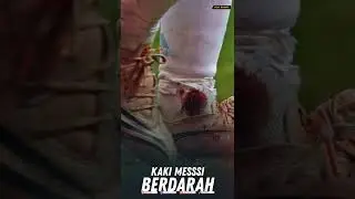 Until it bleeds,🔥 The day Messi fought for Argentina to the last drop of blood