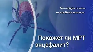 Диагностика энцефалита