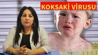 YAYILMIŞ KOKSAKİ VİRUSU HAQQINDA