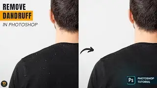 How to Easily Clean Up Dandruff in Photos Using Photoshop