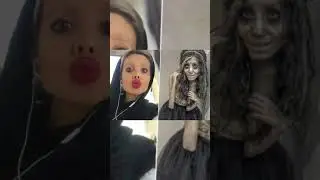Эта Пластическая ОПЕРАЦИЯ Зашла Слишком Далеко🤯