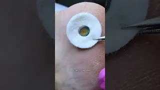 обработка бород@вки 