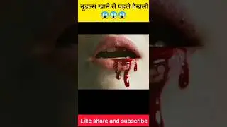 नूडल्स खाने वाले जरूर देखें 😱 