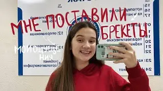 МНЕ ПОСТАВИЛИ БРЕКЕТЫ! // Как Ставят Брекеты?