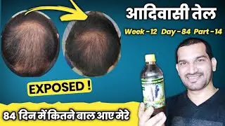 Adivasi Hair oil honest review | Adivasi Neelambari Herbal Hair Oil | Adivasi Hair Oil Review