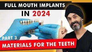 Materials of the Teeth for All on 4 - Full set of Dental Implants