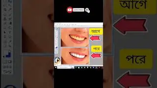 How To Whiten Teeth in photoshop 7.0 😍 