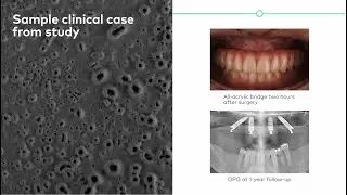 Xeal & TiUltra: The clinically proven surfaces